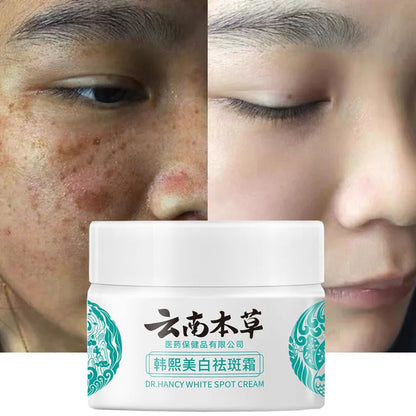20g Herb Powerful Whitening Freckle Cream Remove Acne Spots Melanin Dark Spots Face Moisturizing Face Skin Care Beauty Yun Nan