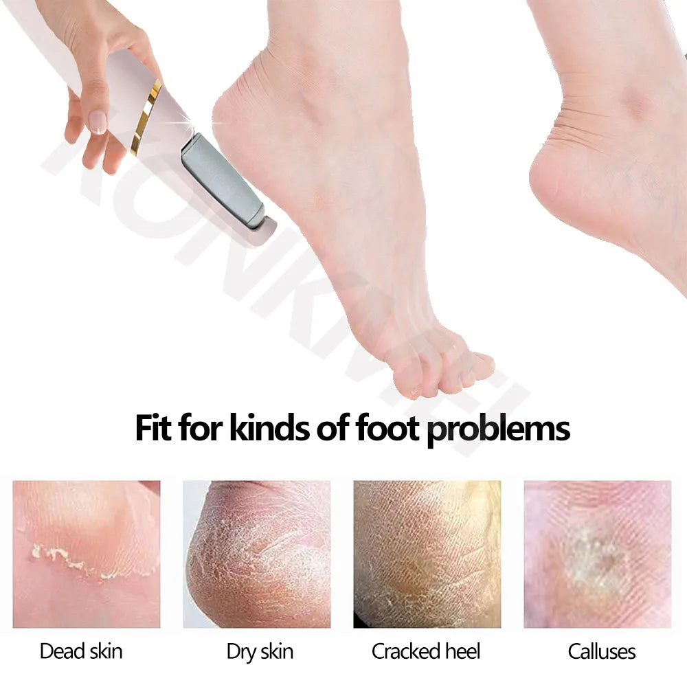 2024New Electric Foot Grinding Skin Hard Rupture Skin Trimmer Dead Skin Foot Pedicure Rechargeable Foot Care Tool Remover Callus