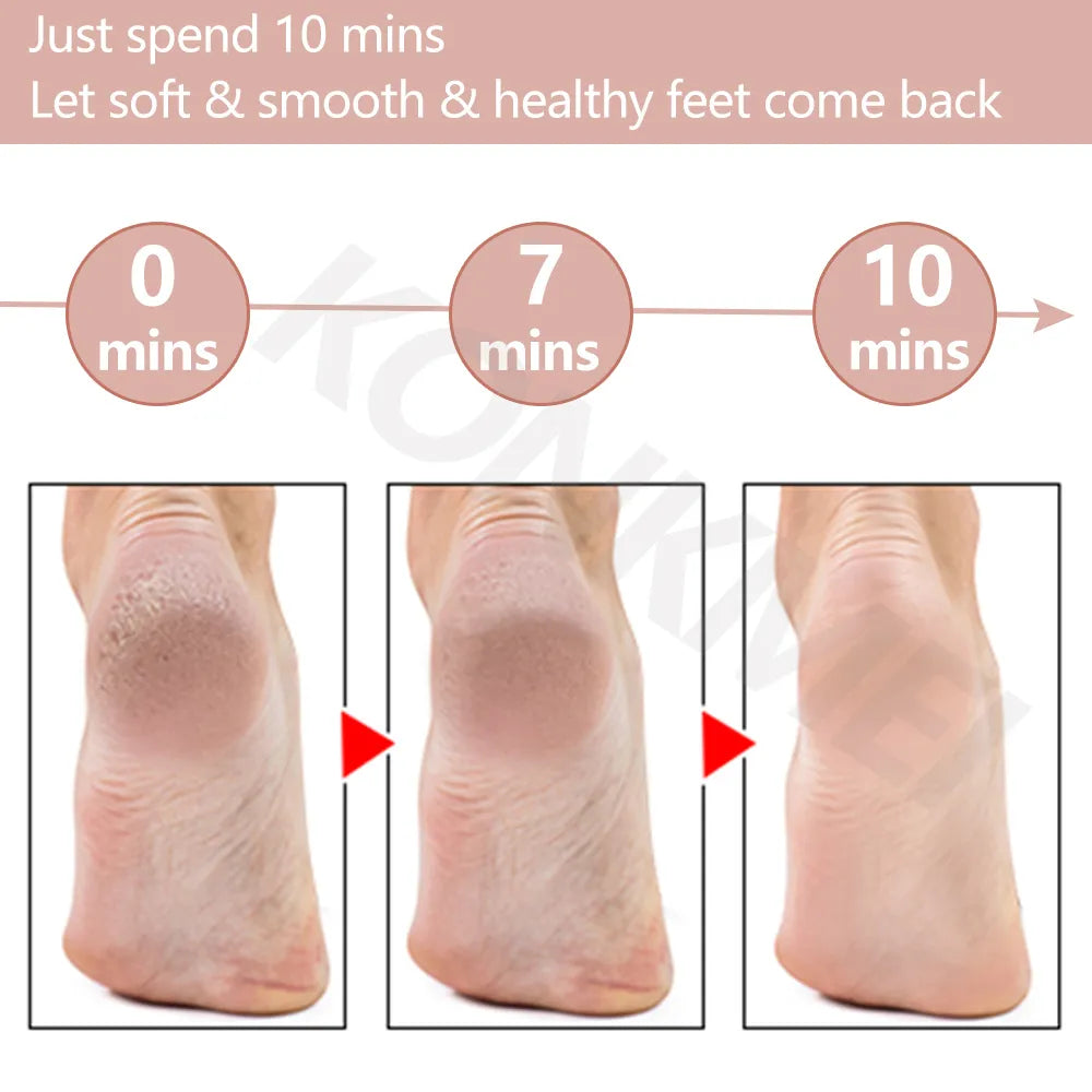 2024New Electric Foot Grinding Skin Hard Rupture Skin Trimmer Dead Skin Foot Pedicure Rechargeable Foot Care Tool Remover Callus