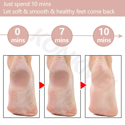 2024New Electric Foot Grinding Skin Hard Rupture Skin Trimmer Dead Skin Foot Pedicure Rechargeable Foot Care Tool Remover Callus
