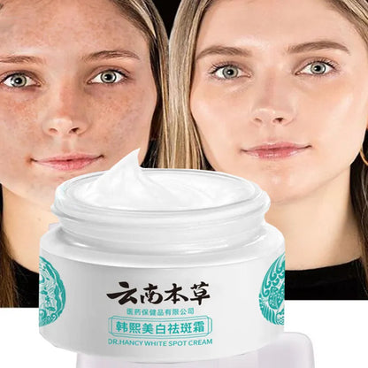 20g Herb Powerful Whitening Freckle Cream Remove Acne Spots Melanin Dark Spots Face Moisturizing Face Skin Care Beauty Yun Nan